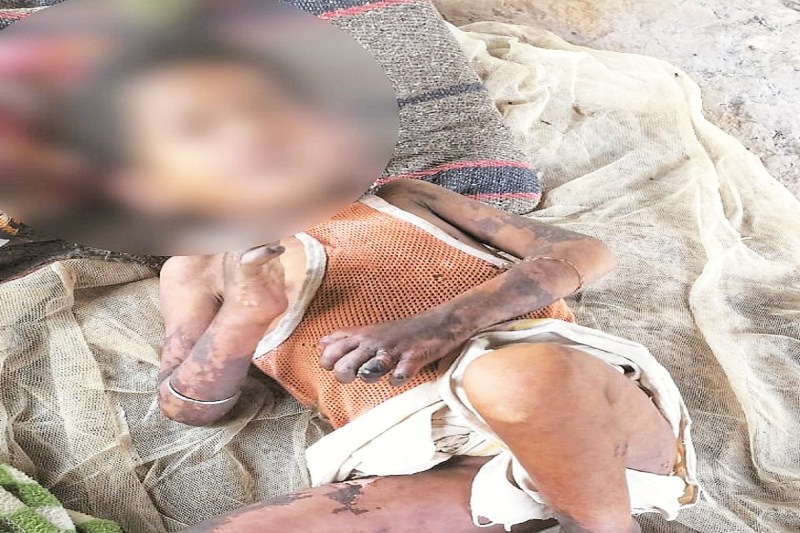 जिंदगी और मौत से जूझ रहा अबुझमाड़ का मासूम वड्डा (Photo source- Patrika)