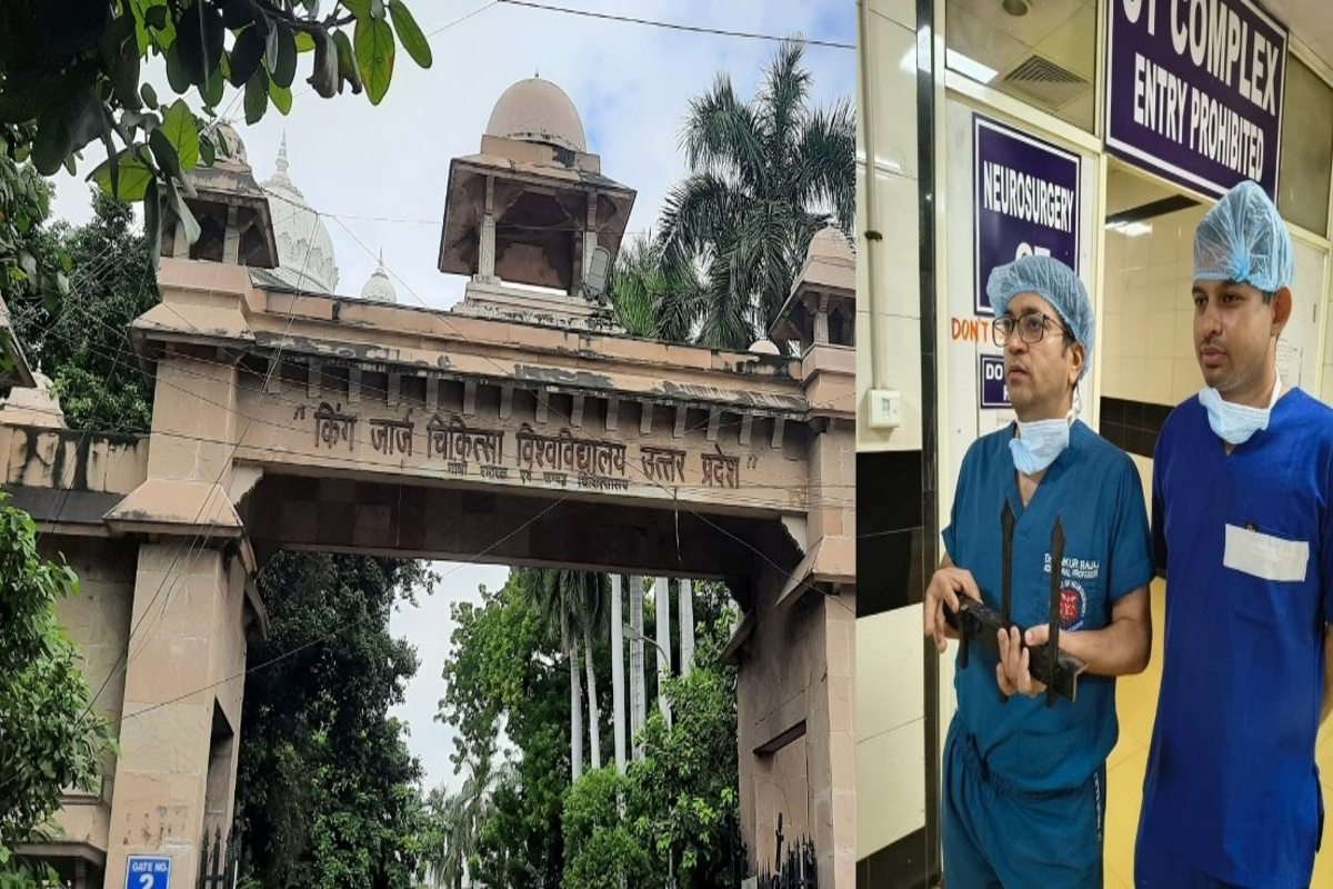 KGMU का करिश्मा: सिर में आर-पार लोहे की छड़, मासूम कार्तिक की जान बची