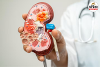 5 Warning Signs of Kidney Failure