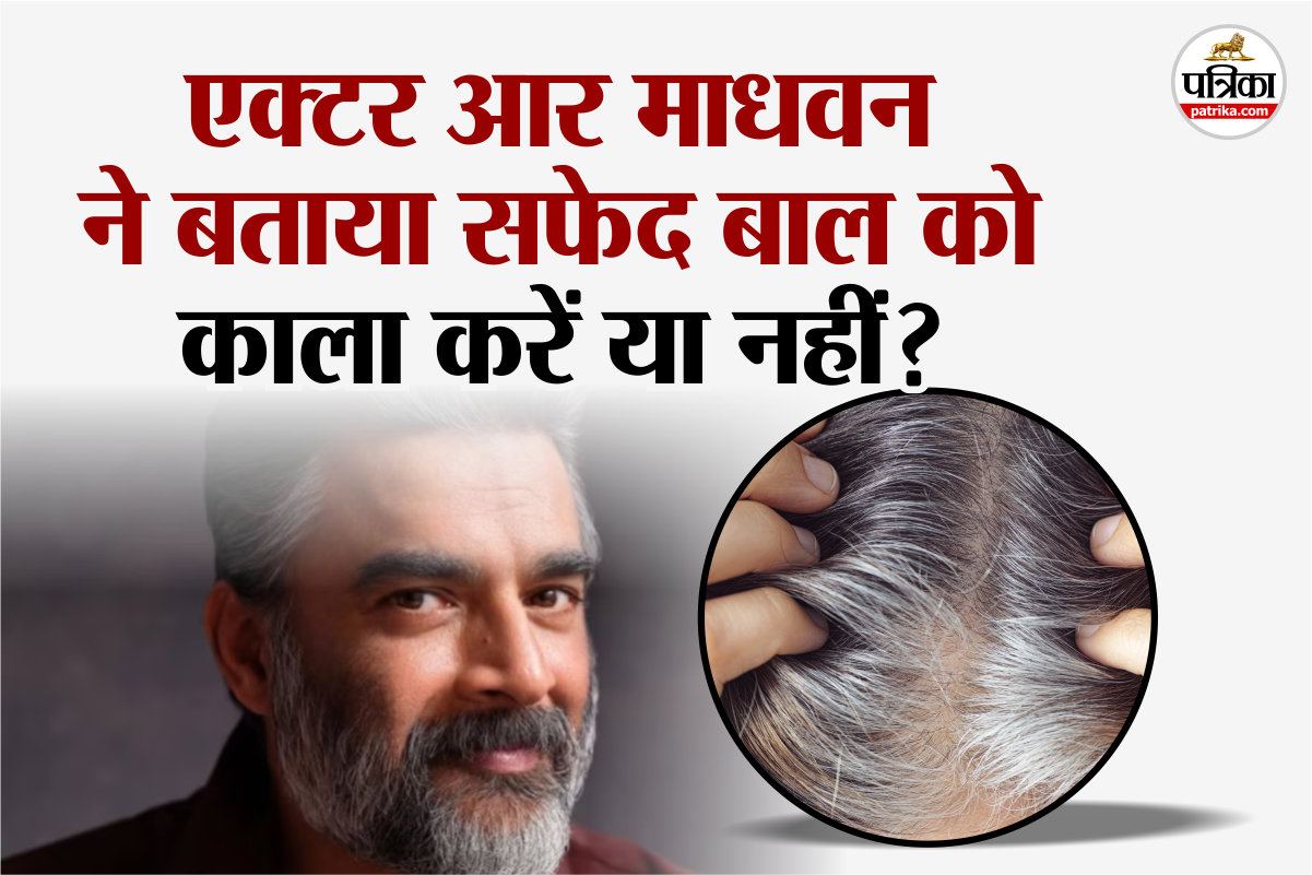 White Hair, White Hair problem, Actor R Madhavan, dye for black Hair, White Hair reason,