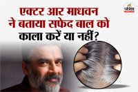 White Hair, White Hair problem, Actor R Madhavan, dye for black Hair, White Hair reason,