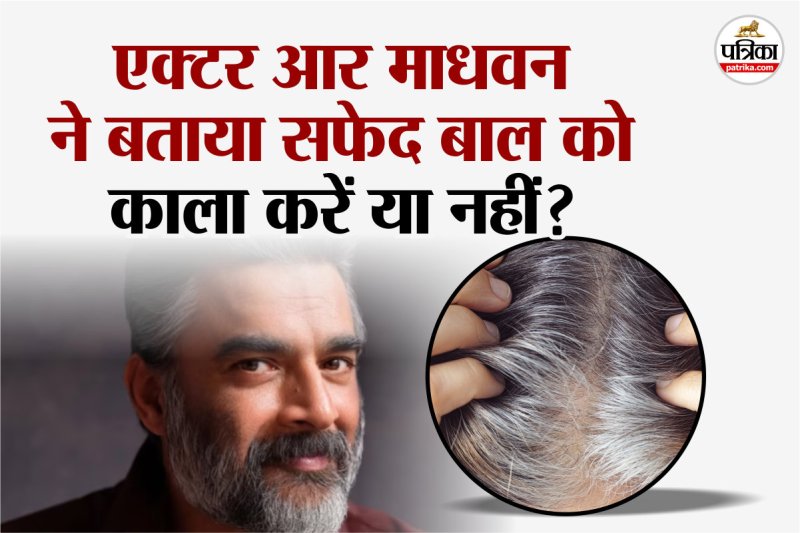 White Hair, White Hair problem, Actor R Madhavan, dye for black Hair, White Hair reason,