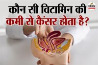 Vitamin D and colorectal cancer,prevent colorectal cancer,Vitamin D deficiency,