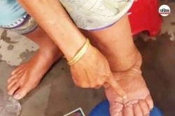योगी सरकार का लक्ष्य 2027 तक ‘फाइलेरिया मुक्त हो उत्तर प्रदेश’, उन्मूलन अभियान
शुरू - image