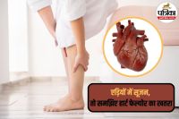 Swelling in ankles, Heart failure, Peripheral edema, Causes of ankle swelling,