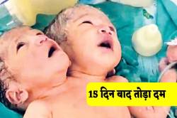 नहीं रही दो सिर वाली मासूम, घर ले जाने के एक दिन बाद ही तोड़ा दम, हर किसी की
आंखें नम - image