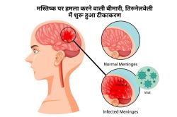 Japanese Encephalitis : जानलेवा जापानी बुखार, जानें लक्षण और टीकाकरण क्यों है
जरूरी - image