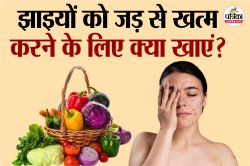 Food For Skin Pigmentation: बिना महंगे ट्रीटमेंट के हटाएं झाइयां, बस अपनी डाइट
में लाएं ये बदलाव - image