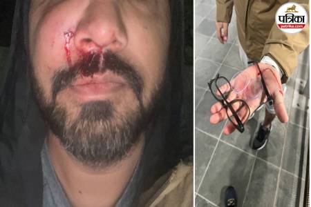 Racist Attacks on Indians in Ireland