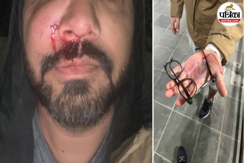 Racist Attacks on Indians in Ireland