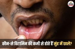 Vitamin Deficiency Mouth Ulcers: मुंह में जलन और छाले बार-बार हो रहे हैं? ये 5
घरेलू चीजें तुरंत राहत देंगी - image