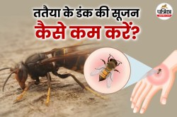 Wasp Bite: ततैया के काटने के बाद सूजन को कम करने के घरेलू उपाय - image