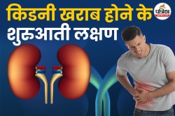 Early Signs of Kidney Disease: हाथ-पैरों में नजर आएं ये संकेत, तो समझ लें किडनी
हो रही है कमजोर - image