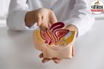 Bowel Cancer Early Signs