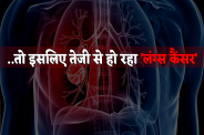 Lungs Cancer Cases