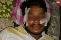 चौपुला पुल पर चीनी मांझे की चपेट में आने से बाइक सवार युवक बुरी तरह जख्मी,
नाक-आंख पर लगे 10 टांके - image