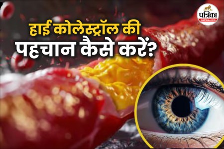 high cholesterol symptoms,eye health and cholesterol,cholesterol impact on eyes,