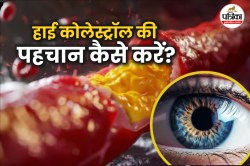 Symptoms Of High Cholesterol: आंखों में सफेद रिंग या धुंधलापन? ये 5 लक्षण बढ़े
हुए कोलेस्ट्रॉल का इशारा हो सकते हैं - image