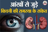 Can kidney problems cause dry eyes,Kidney Damage Signs, healthy eyes,