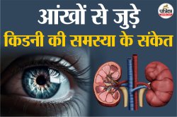 Kidney Damage Signs: आंखों के ये 6 लक्षण बता सकते हैं किडनी का हाल, इन संकेतों
को न करें नजरअंदाज - image