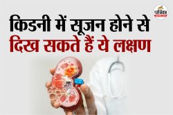 Kharab Kidney Ke Lakshan: बार-बार थकान और सूजन का कारण सिर्फ कमजोरी नहीं, हो
सकती है किडनी में सूजन प्रॉब्लम - image