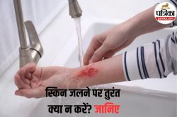 Burn Home Remedies: गर्म तवे या कढ़ाही से जल गया हाथ? ये 5 गलती बिल्कुल न करें,
वरना बढ़ेगा इंफेक्शन का खतरा - image
