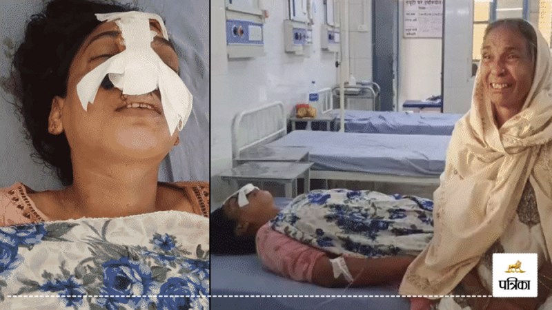 moradabad husband attacks wife nose cut mayke