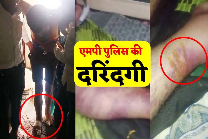 third degree Torture gave to dalits in police custody MP congress leader blamed mp police