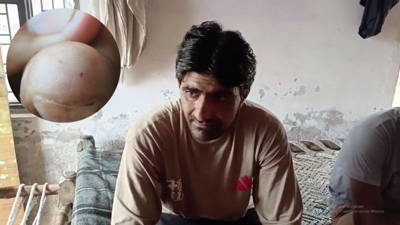 young man Snake bite