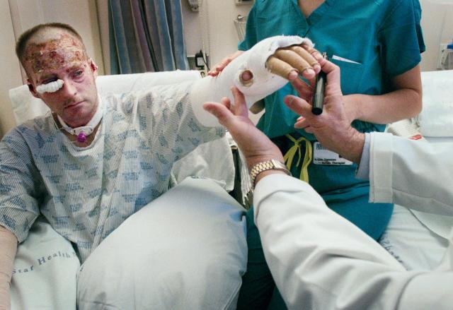 9-11 injured people