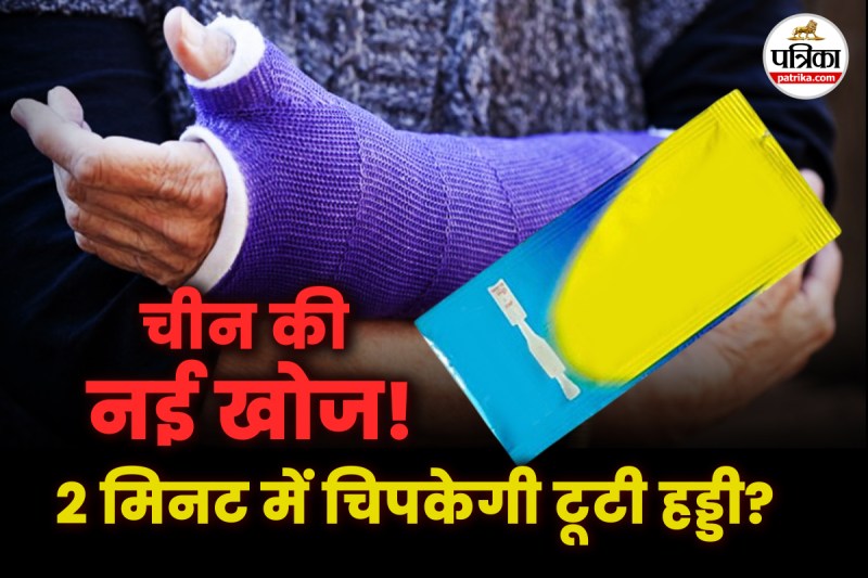 Bone Glue, China made Bone Glue, Bone Glue Kya hai, Bone Glue for fracture,