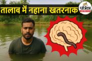 Brain Eating Amoeba