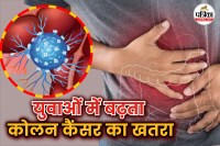 Health news, Colon Cancer,Young adult cancer prevention,