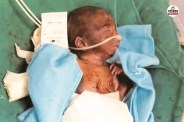 Shameful Rajasthan Bhilwara Pali Now Dungarpur a newborn was found outside a hospital his condition critical