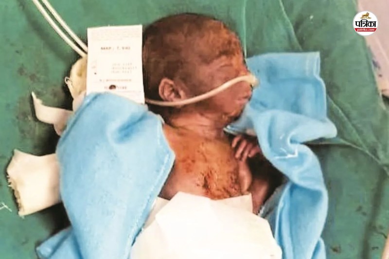 Shameful Rajasthan Bhilwara Pali Now Dungarpur a newborn was found outside a hospital his condition critical