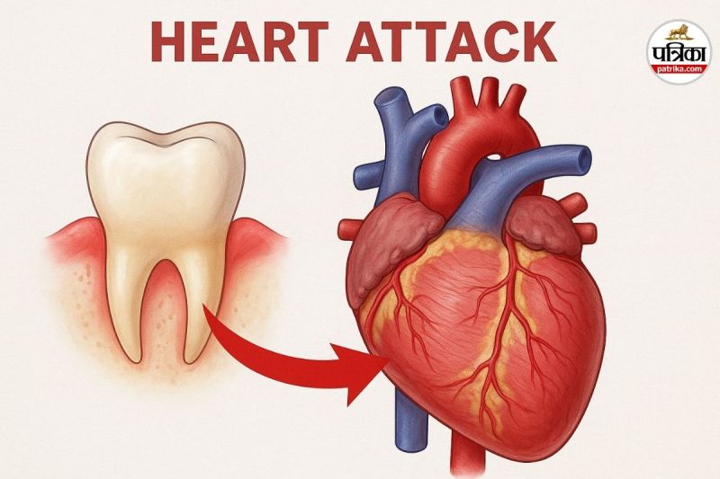 Heart attack and oral hygiene, poor dental health heart risk, oral hygiene and cardiovascular disease, study on oral health and heart attack,