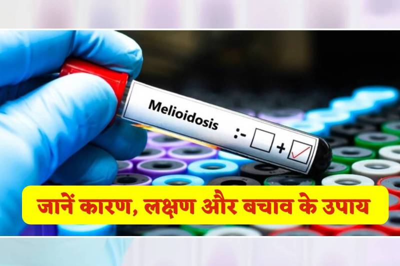 Meliodosis symptoms causes prevention tips