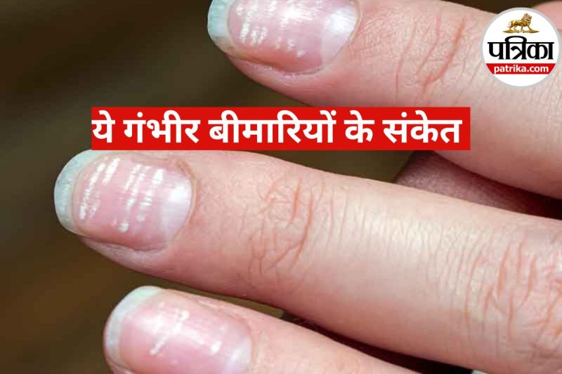 Nail Health Problems