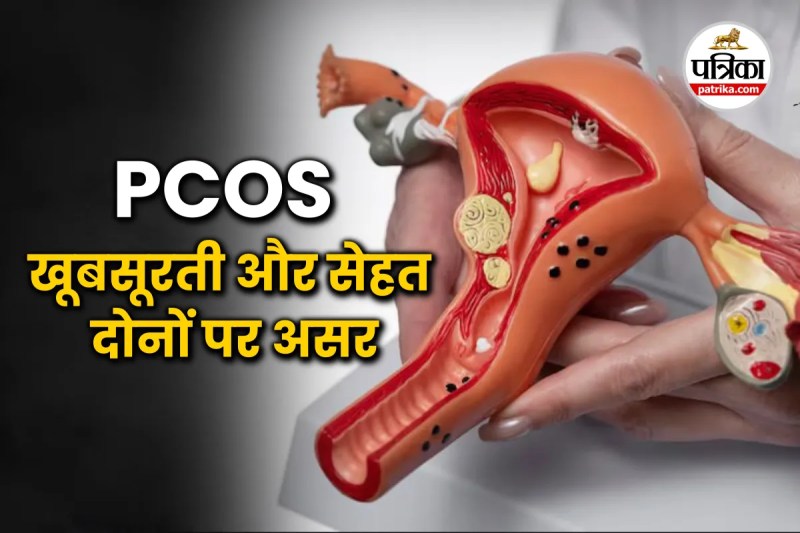 PCOS symptoms,women with PCOS,Hormonal Imbalance,PCOS on skin,