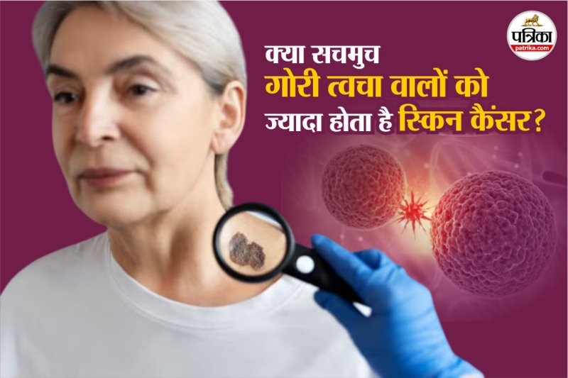 is skin cancer more common in fair skin,skin cancer,white people skin cancer,