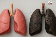 Smoking related cancers, pancreatic cancer, lung cancer, Cancer spreading beyond lungs due to smoking, Organs affected by cigarette smoking, Smoking causes bladder and throat cancer,