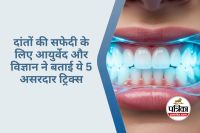 Tricks for Teeth Whitening