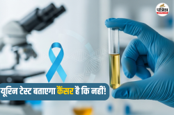 Urine Based Cancer Test: पेशाब से कैंसर का चलेगा पता, नई खोज से मिलेगा दर्दनाक
जांच से राहत - image