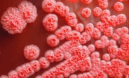 Deadly Melioidosis Virus Spreading Among Farmers in MP