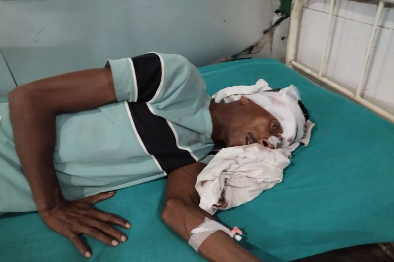 खेत में काम कर रहे किसान पर जंगली जानवर का हमला Farmer working in the field attacked by wild animal