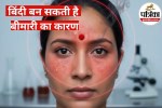 Bindi gum can cause disease