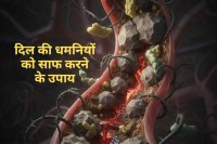Drinks to Prevent Artery Blockage