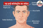 Early Signs of High Cholesterol