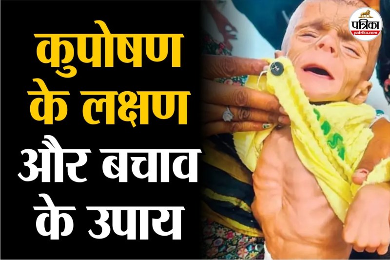 child malnutrition in MP, Early signs of malnutrition,Malnutrition death ,Kuposhan
