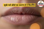 Lip Care Tips